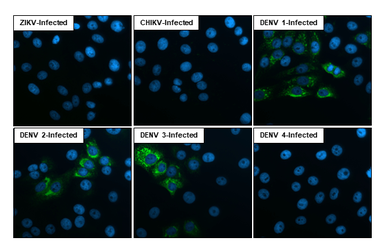 Dengue virus prM protein antibody [HL3287] (GTX640941) | GeneTex中文官方网站