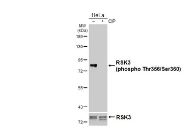 Anti-RSK3 (phospho Thr356/Ser360) antibody [HL3299] used in Western Blot (WB). GTX640988