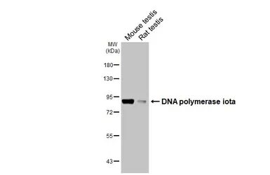 Anti-DNA polymerase iota antibody [HL3310] used in Western Blot (WB). GTX641072