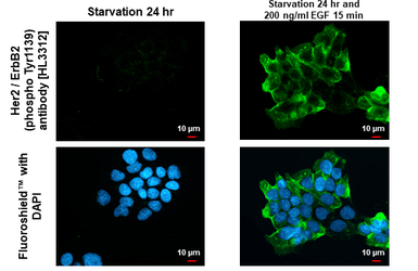 Anti-Her2 / ErbB2 (phospho Tyr1139) antibody [HL3312] used in Immunocytochemistry/ Immunofluorescence (ICC/IF). GTX641074