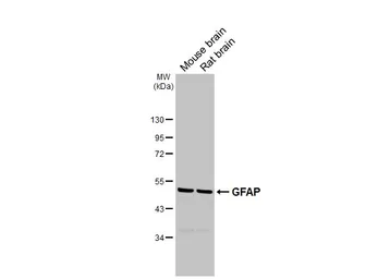 Anti-GFAP antibody [GT25] used in Western Blot (WB). GTX641104