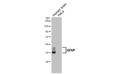 Anti-GFAP antibody [GT25] used in Western Blot (WB). GTX641104