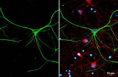 Anti-GFAP antibody [GT25] used in Immunocytochemistry/ Immunofluorescence (ICC/IF). GTX641104