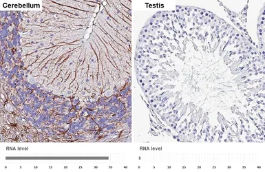 Anti-GFAP antibody [GT25] used in IHC (Paraffin sections) (IHC-P). GTX641104