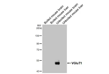 Anti-VGluT1 antibody [GT34] used in Western Blot (WB). GTX641142