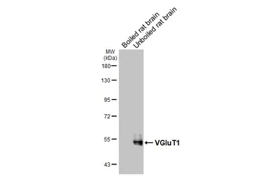 Anti-VGluT1 antibody [GT34] used in Western Blot (WB). GTX641142