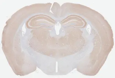 Anti-VGluT1 antibody [GT34] used in IHC (Paraffin sections) (IHC-P). GTX641142