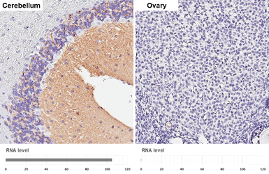 Anti-VGluT1 antibody [GT34] used in IHC (Paraffin sections) (IHC-P). GTX641142