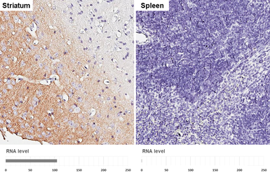 Anti-VGluT1 antibody [GT34] used in IHC (Paraffin sections) (IHC-P). GTX641142