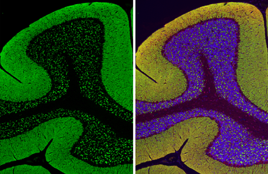Anti-VGluT1 antibody [GT34] used in IHC (Paraffin sections) (IHC-P). GTX641142