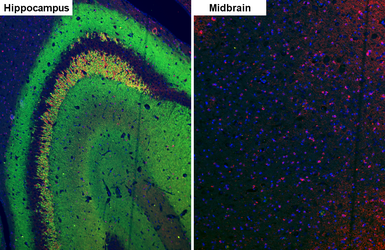 Anti-VGluT1 antibody [GT34] used in IHC (Paraffin sections) (IHC-P). GTX641142