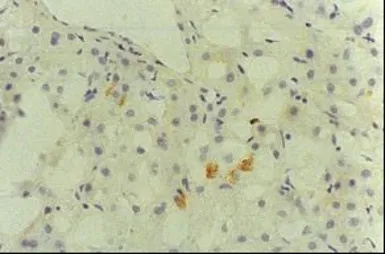 Anti-Hepatitis C virus Core Antigen antibody [H6-29] (FITC) used in Immunohistochemistry (IHC). GTX64115