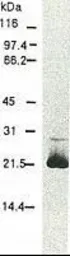 Anti-Hepatitis C virus Core Antigen antibody [H6-29] (FITC) used in Western Blot (WB). GTX64115