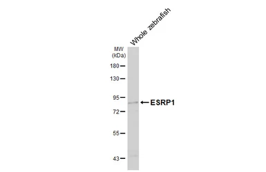 Anti-ESRP1 antibody [HL3413] used in Western Blot (WB). GTX641250