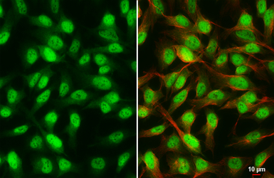 Anti-Rad21 antibody [HL3416] used in Immunocytochemistry/ Immunofluorescence (ICC/IF). GTX641258