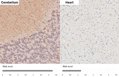 Anti-DLK/MAP3K12 antibody [HL3423] used in IHC (Paraffin sections) (IHC-P). GTX641265