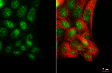Anti-POLR3A antibody [HL3437] used in Immunocytochemistry/ Immunofluorescence (ICC/IF). GTX641310