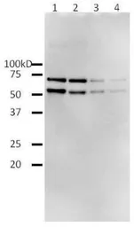Anti-HIV1 Reverse transcriptase antibody used in Western Blot (WB). GTX64133