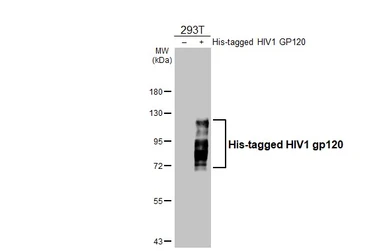 Anti-HIV1 gp120 antibody [GT46] used in Western Blot (WB). GTX641331
