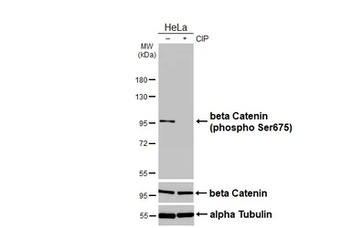Anti-beta Catenin (phospho Ser675) antibody [HL3471] used in Western Blot (WB). GTX641356