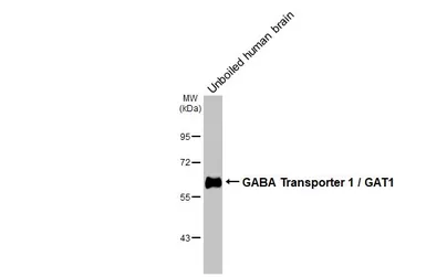 Anti-GABA Transporter 1 / GAT1 antibody [HL3475] used in Western Blot (WB). GTX641360