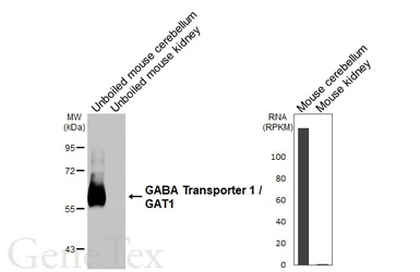 Anti-GABA Transporter 1 / GAT1 antibody [HL3475] used in Western Blot (WB). GTX641360