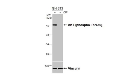Anti-AKT (phospho Thr450) antibody [HL3478] used in Western Blot (WB). GTX641363