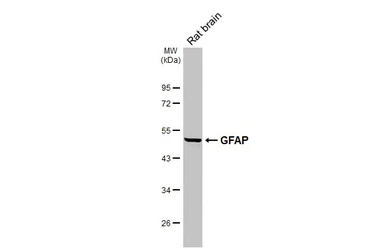 Anti-GFAP antibody [GT51] used in Western Blot (WB). GTX641375