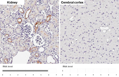 Anti-XPNPEP2 antibody [HL3492] used in IHC (Paraffin sections) (IHC-P). GTX641380