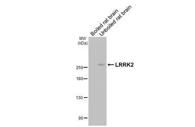 Anti-LRRK2 antibody [GT53] used in Western Blot (WB). GTX641405