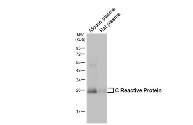 Anti-C Reactive Protein antibody [GT55] used in Western Blot (WB). GTX641407