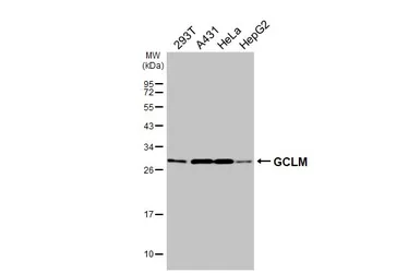 Anti-GCLM antibody [HL3517] used in Western Blot (WB). GTX641414