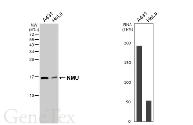 Anti-NMU antibody [HL3549] used in Western Blot (WB). GTX641455