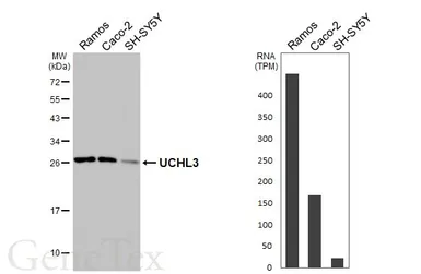 Anti-UCHL3 antibody [HL3564] used in Western Blot (WB). GTX641470