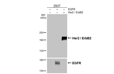 Anti-Her2 / ErbB2 antibody [HL3566] used in Western Blot (WB). GTX641472
