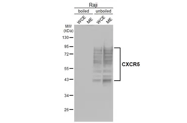 Anti-CXCR5 antibody [HL3568] used in Western Blot (WB). GTX641474