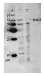 Anti-Rad22 (S. pombe) antibody used in Western Blot (WB). GTX64148
