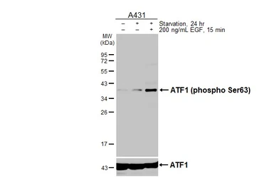 Anti-ATF1 (phospho Ser63) antibody [HL3581] used in Western Blot (WB). GTX641552