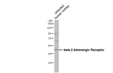Anti-beta 2 Adrenergic Receptor antibody [HL3594] used in Western Blot (WB). GTX641565