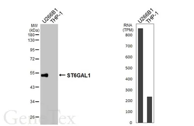 Anti-ST6GAL1 antibody [HL3611] used in Western Blot (WB). GTX641586