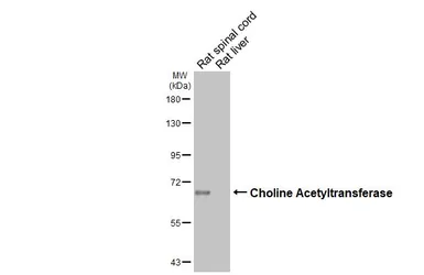 Anti-Choline Acetyltransferase antibody [HL3617] used in Western Blot (WB). GTX641592