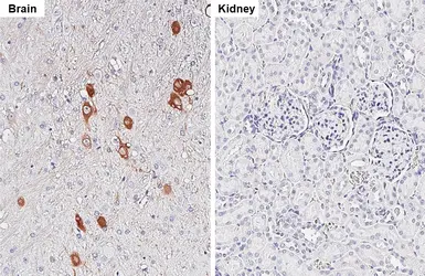 Anti-Choline Acetyltransferase antibody [HL3617] used in IHC (Paraffin sections) (IHC-P). GTX641592