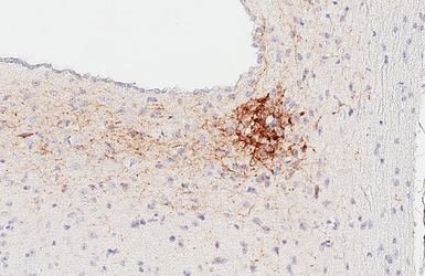 Anti-VPAC2 antibody [HL3625] used in IHC (Paraffin sections) (IHC-P). GTX641600