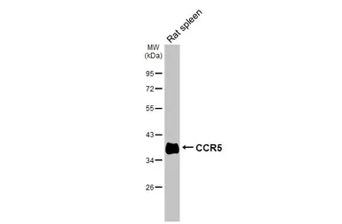 Anti-CCR5 antibody [HL3650] used in Western Blot (WB). GTX641641