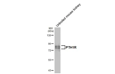Anti-PTH1R antibody [HL3651] used in Western Blot (WB). GTX641642