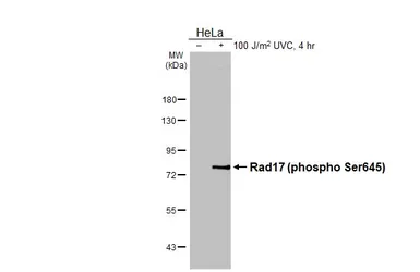 Anti-Rad17 (phospho Ser645) antibody [HL3676] used in Western Blot (WB). GTX641704