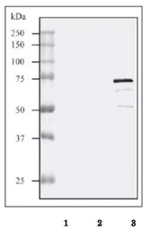 Anti-Streptolysin O antibody used in Western Blot (WB). GTX64171