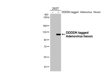 Anti-Adenovirus hexon antibody [HL3684] used in Western Blot (WB). GTX641712