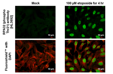 Anti-RPA32 (phospho Thr21) antibody [HL3692] used in Immunocytochemistry/ Immunofluorescence (ICC/IF). GTX641864