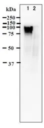 Anti-Varicella Zoster virus gE antibody [#9] used in Western Blot (WB). GTX64187